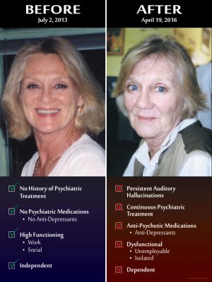 Before-After